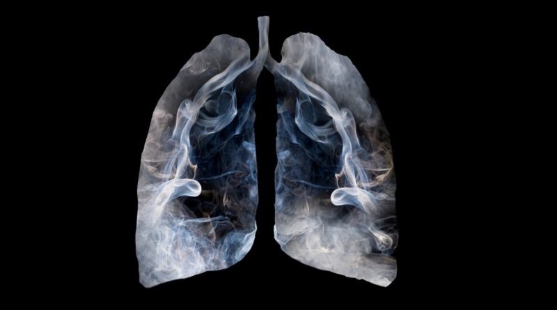 Radiografía de pulmones afectados por el tabaco.